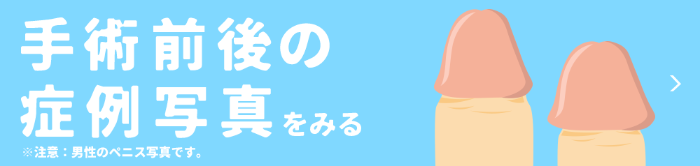 症例写真をみる