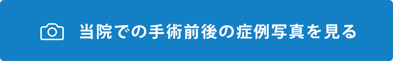 症例写真をみる