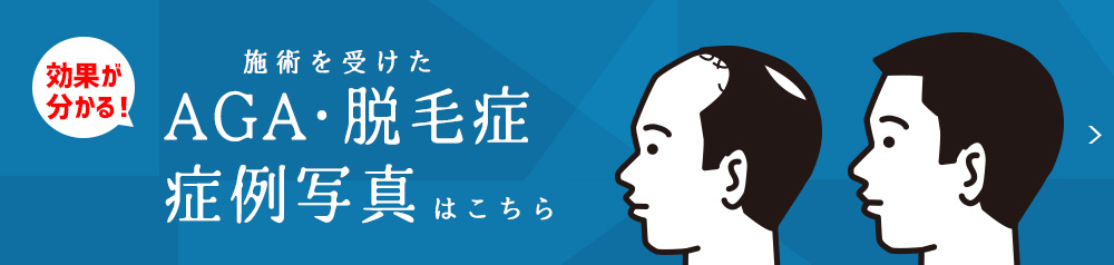 症例写真をみる