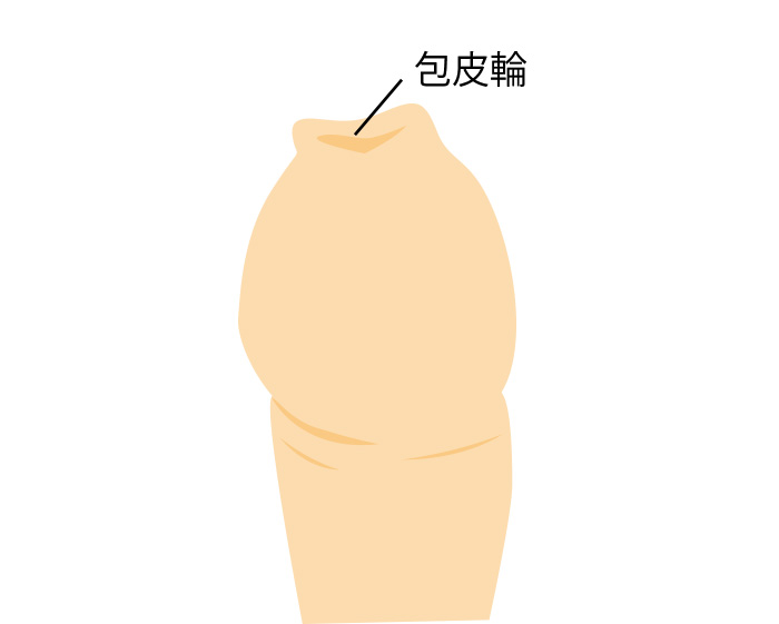 包皮輪