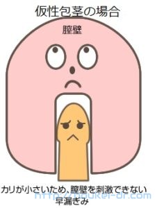 仮性包茎の状態と露茎の比較図