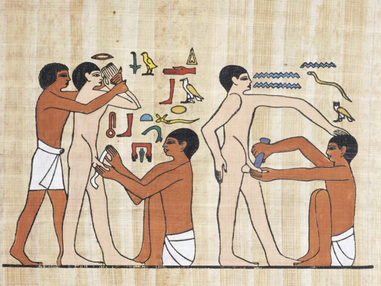 紀元前4000年から行われている包茎手術の歴史