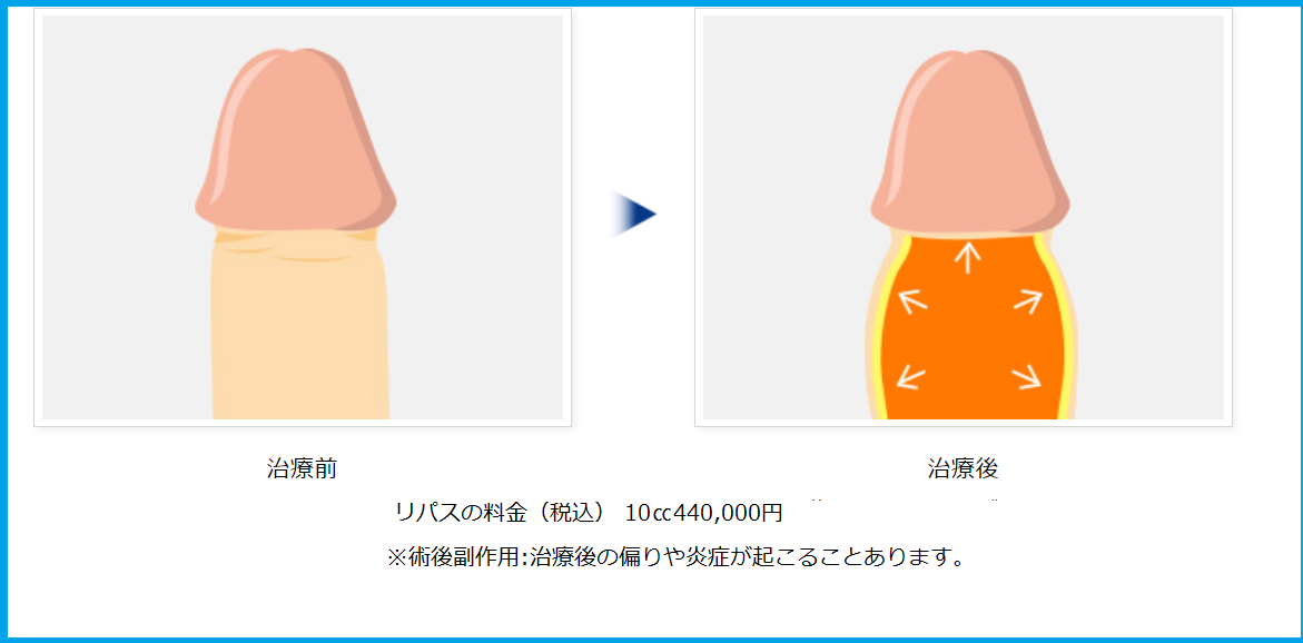 リパスの治療前後
