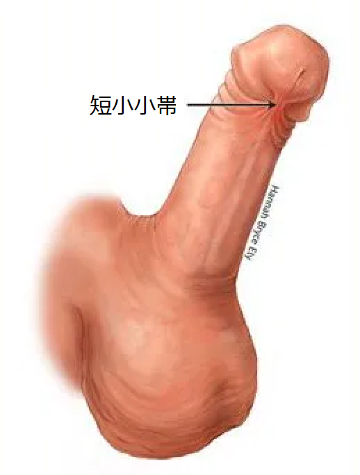 短小小帯