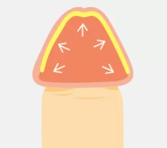 亀頭増大