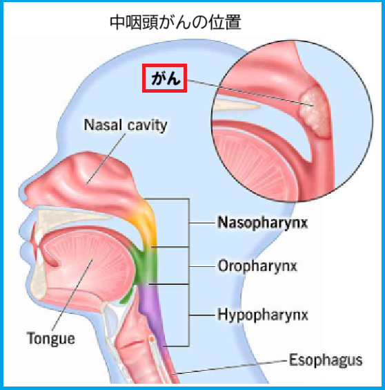中咽頭がんの位置