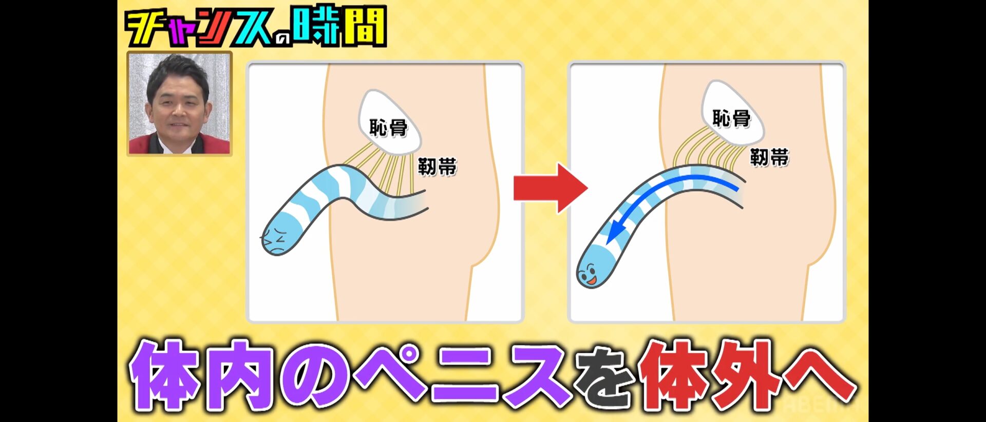 チャンスの時間「平子さんの長茎手術」