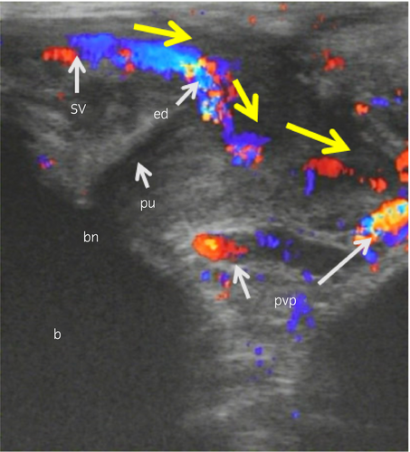 図1：男の潮吹き