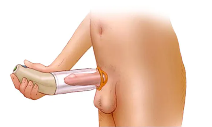 ビガー2020とED1000、どっちがいい？