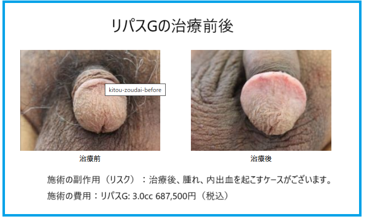 リパスGの治療前後